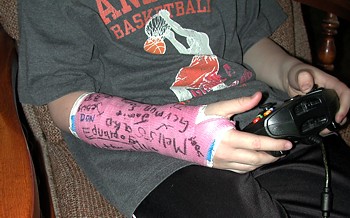 Andrew with arm cast - March 9, 2004