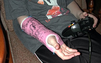 Andrew with arm cast - March 9, 2004